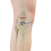 Fractures of the Patella