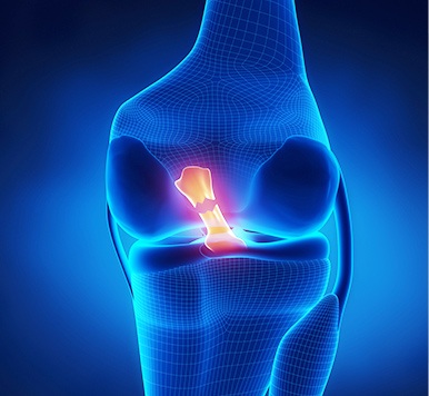 Soft Tissue or Sports Knee Surgery